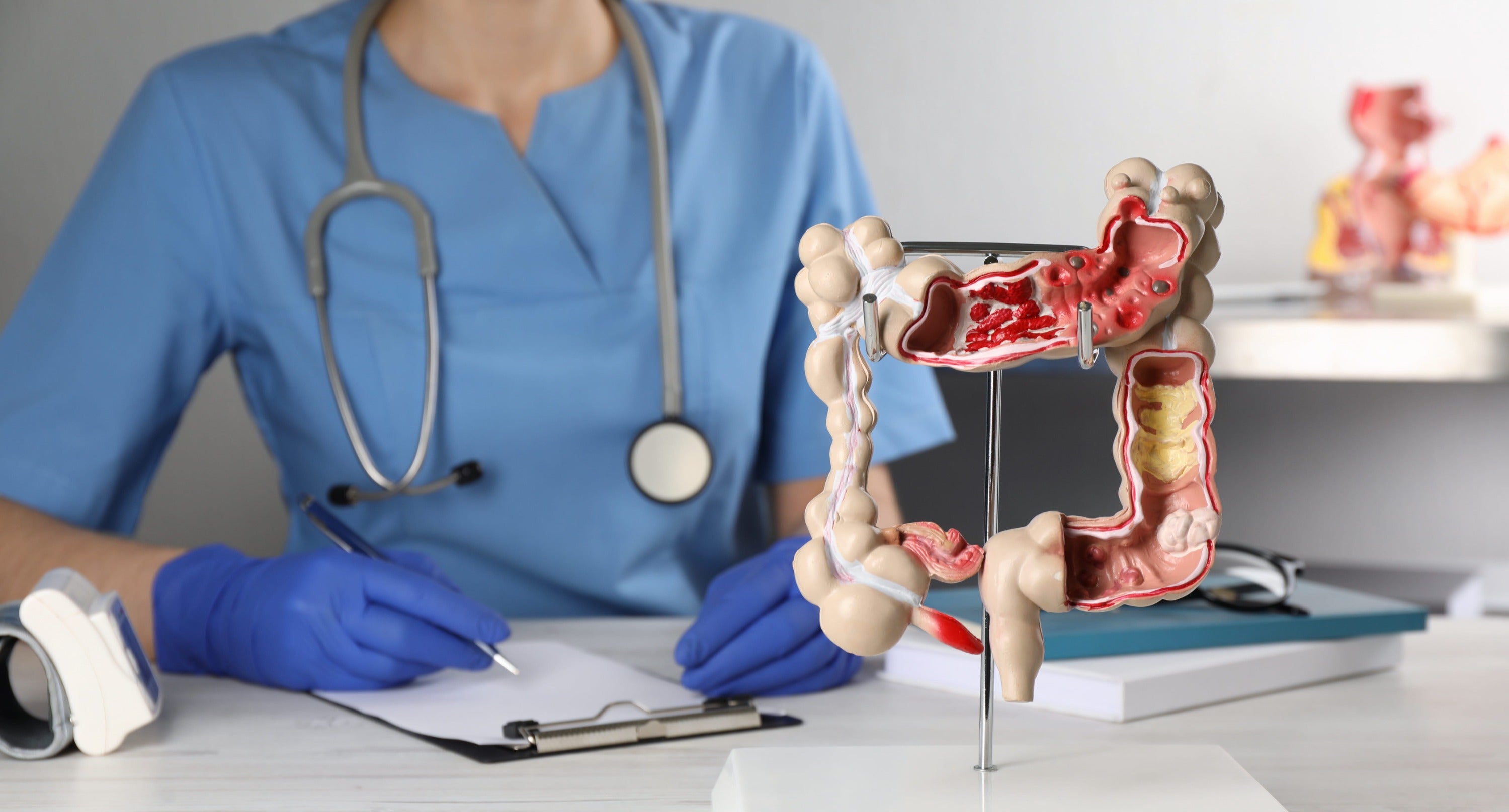 What to expect in Colon Cancer Surgery
